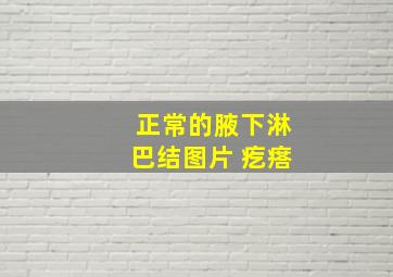 正常的腋下淋巴结图片 疙瘩